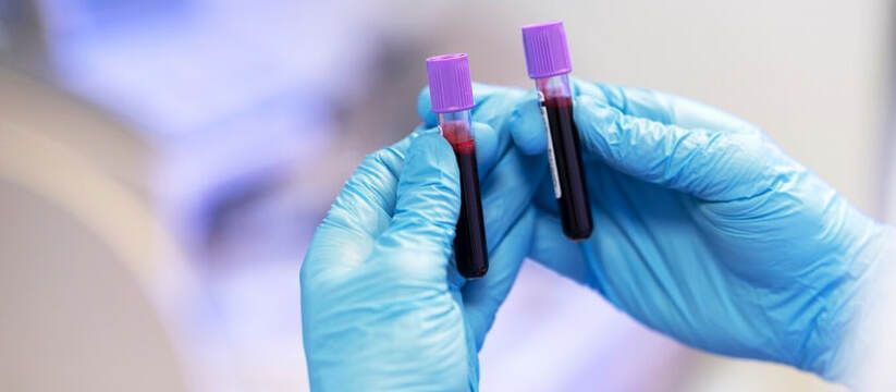 Уникальная группа крови: загадка природы или вызов для медицины?